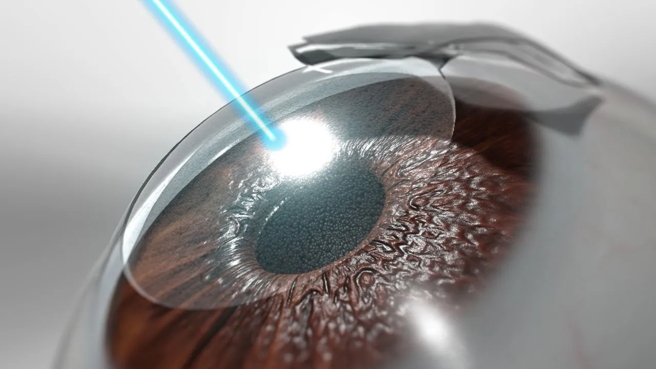 Lasik & Cataract